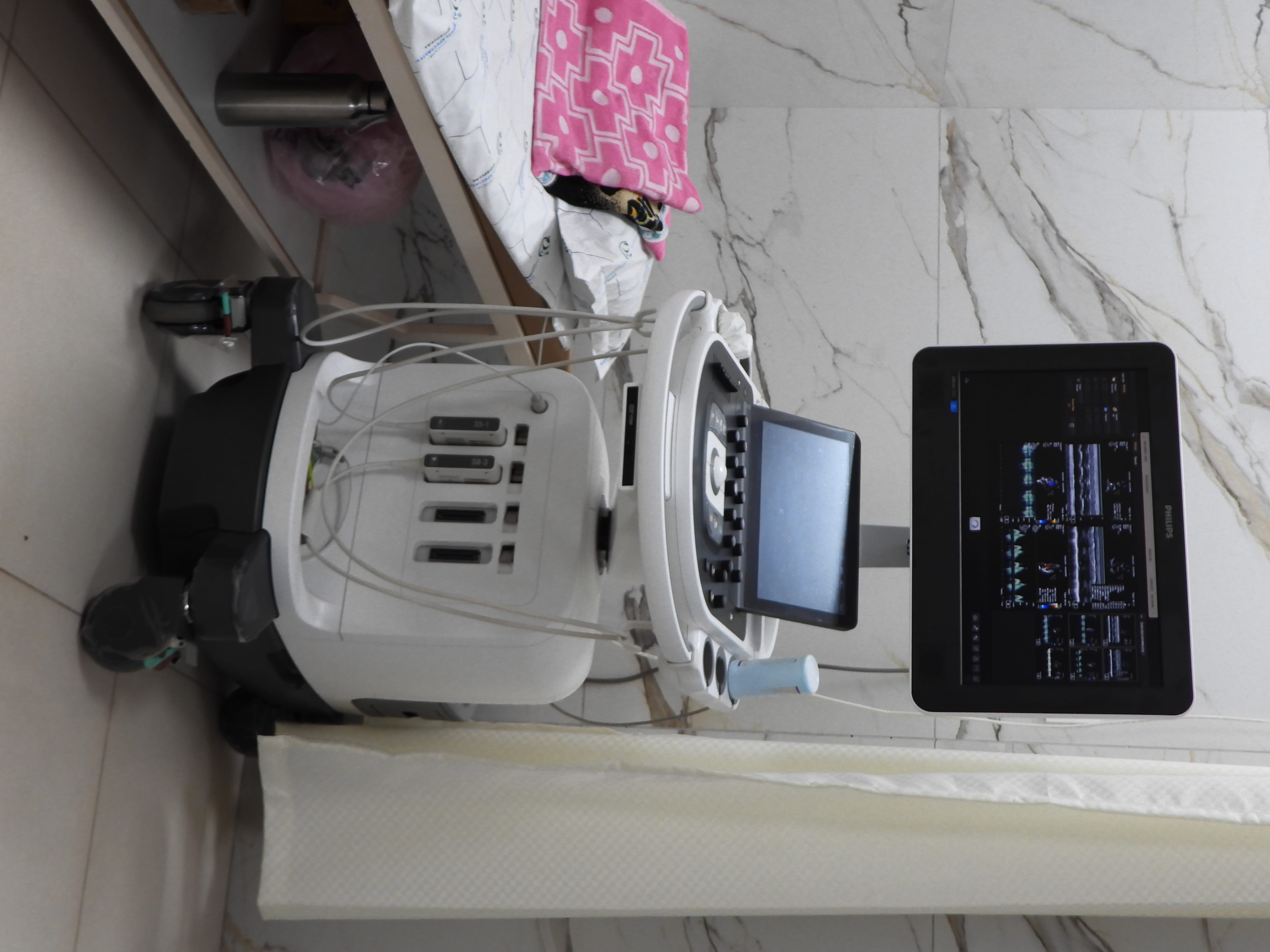 Echo Cardiography at Thulir Hospital